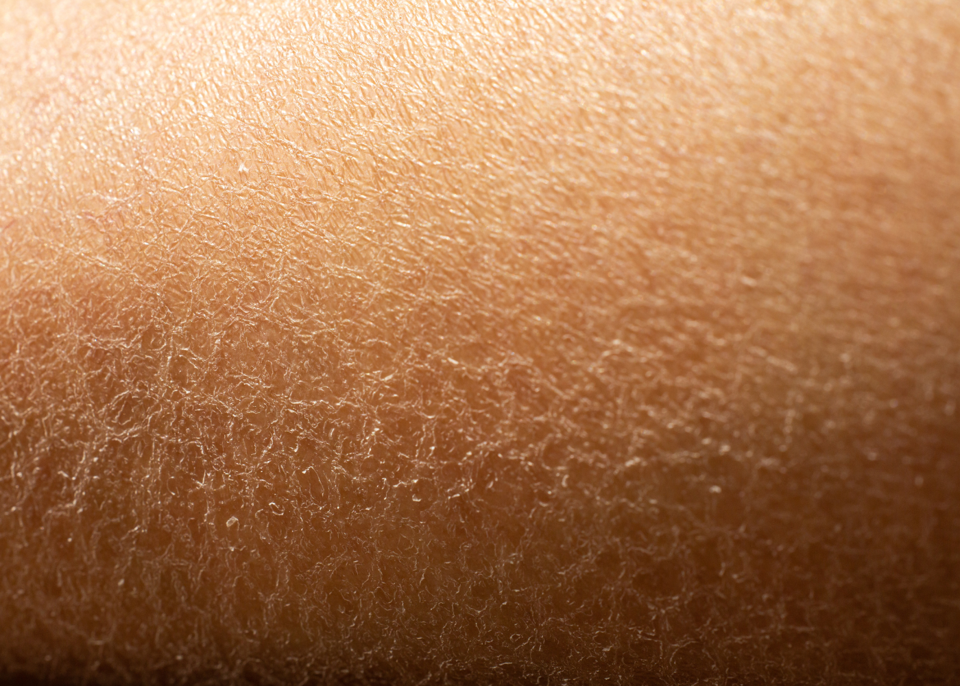 4 Skin Items to Add to Your Dry Skin Routine